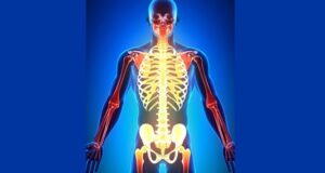 Pessoas com fibromialgia sentem dor no corpo todo Imagem: iStock… - Veja mais em https://noticias.uol.com.br/saude/ultimas-noticias/redacao/2025/07/24/fibromialgia-pcd.htm?cmpid=copiaecola