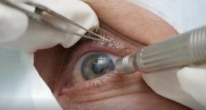 Conselho Brasileiro de Oftalmologia alerta que ausência de consultas regulares pode atrasar diagnóstico de doenças oculares graves.