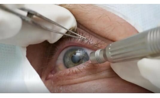 Conselho Brasileiro de Oftalmologia alerta que ausência de consultas regulares pode atrasar diagnóstico de doenças oculares graves.