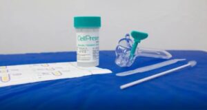 Ministério da Saúde passa a disponibilizar teste DNA-HPV no SUS para rastrear e prevenir o câncer de colo do útero.