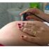Pesquisa mostra redução de episiotomia e manobra de Kristeller em partos vaginais no SUS nos últimos dez anos.